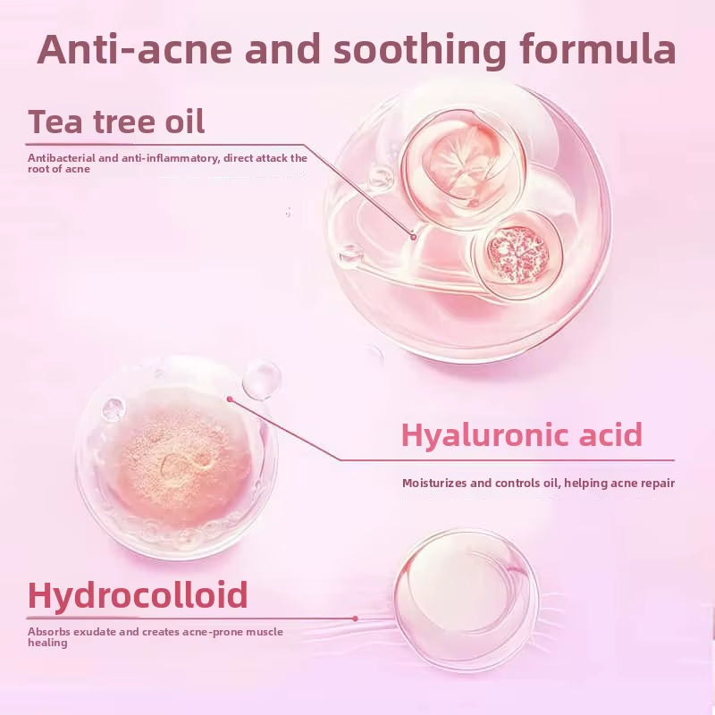 Sanrio Hello Kitty Acne Stickers Cartoon Cute High Appearance Gentle Non-Irritating Hydrocolloid Thin Breathable Acne Stickers